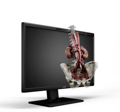 医療用液晶スクリーン